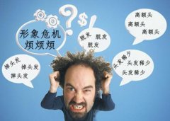 掉頭發是什么原因導致的